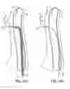 Fig. 19 - Methods of Transvascular Retrograde Access Placement and Devices for Facilitating the Placement