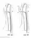 Fig. 24 - Methods of Transvascular Retrograde Access Placement and Devices for Facilitating the Placement