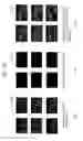 Fig. 24 - TISSUE MALIGNANT TUMOR DETECTION METHOD AND TISSUE MALIGNANT TUMOR DETECTION APPARATUS