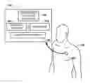Fig. 01 - Assessing autonomic activity using baroreflex analysis