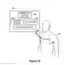 Fig. 04 - Assessing autonomic activity using baroreflex analysis
