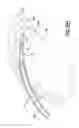Fig. 28 - Bone marrow aspiration needle