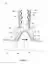 Fig. 13 - METHOD AND APPARATUS FOR TREATMENT OF ADIPOSE TISSUE