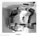 Fig. 07 - Non-Invasive Cervical-Thoracic Correction System
