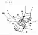 Fig. 03 - SUPPORT FOR FOOT INJURIES