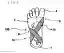 Fig. 05 - SUPPORT FOR FOOT INJURIES