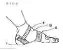Fig. 07 - SUPPORT FOR FOOT INJURIES