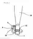 Fig. 08 - SUPPORT FOR FOOT INJURIES
