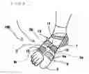 Fig. 10 - SUPPORT FOR FOOT INJURIES