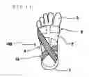 Fig. 12 - SUPPORT FOR FOOT INJURIES