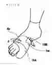 Fig. 13 - SUPPORT FOR FOOT INJURIES