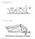 Fig. 14 - SUPPORT FOR FOOT INJURIES