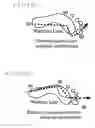 Fig. 15 - SUPPORT FOR FOOT INJURIES