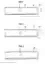 Fig. 02 - Neural injection system and related methods