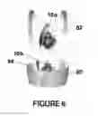 Fig. 07 - Anatomically engineered configured article