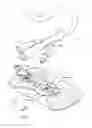 Fig. 01 - Anchoring system for a medical article