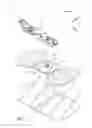 Fig. 02 - Anchoring system for a medical article