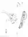 Fig. 22 - Anchoring system for a medical article
