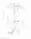 Fig. 01 - Methods of transvascular retrograde access placement and devices for facilitating the placement