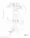 Fig. 03 - Methods of transvascular retrograde access placement and devices for facilitating the placement