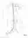 Fig. 05 - Methods of transvascular retrograde access placement and devices for facilitating the placement