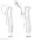 Fig. 08 - Methods of transvascular retrograde access placement and devices for facilitating the placement
