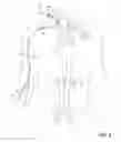 Fig. 12 - Methods of transvascular retrograde access placement and devices for facilitating the placement