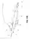 Fig. 17 - Methods of transvascular retrograde access placement and devices for facilitating the placement