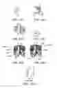 Fig. 45 - Ostomy containment device