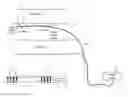 Fig. 01 - RENAL DENERVATION CATHETER AND METHOD USING pH ALTERATION