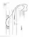 Fig. 09 - RENAL DENERVATION CATHETER AND METHOD USING pH ALTERATION