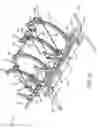 Fig. 03 - Orthopedic fixation systems and methods