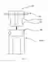 Fig. 08 - Intramedullary nails for long bone fracture setting
