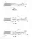 Fig. 02 - Method and apparatus for spinal osteoligamentous resection