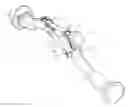 Fig. 01 - Prosthetic acetabular cup inserter and impactor