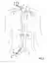 Fig. 07 - Methods of transvascular retrograde access placement and devices for facilitating therein