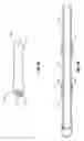 Fig. 07 - MULTI-SEGMENT PROTECTIVE SHEATH FOR EXPANDABLE MEDICAL DEVICES