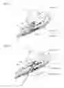 Fig. 35 - STRUCTURES FOR OCCLUDING THE UTERINE ARTERY