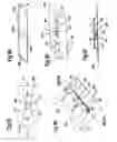 Fig. 22 - DEVICE FOR REMOVING ACROCHORDONS