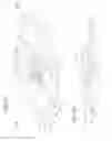 Fig. 33 - DEVICE FOR REMOVING ACROCHORDONS