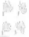 Fig. 62 - DEVICE FOR REMOVING ACROCHORDONS