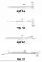 Fig. 08 - Endovascular devices and methods for exploiting intramural space