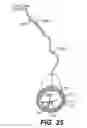 Fig. 35 - Endovascular devices and methods for exploiting intramural space