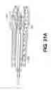 Fig. 46 - Endovascular devices and methods for exploiting intramural space