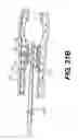 Fig. 47 - Endovascular devices and methods for exploiting intramural space