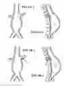 Fig. 06 - Fenestration devices, systems, and methods