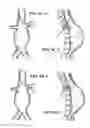 Fig. 07 - Fenestration devices, systems, and methods
