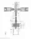 Fig. 08 - Interspinous process spacer diagnostic parallel balloon catheter and methods of use