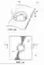 Fig. 20 - Polyaxial fastener systems and methods