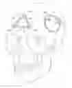 Fig. 01 - Craniotomy closures and plugs